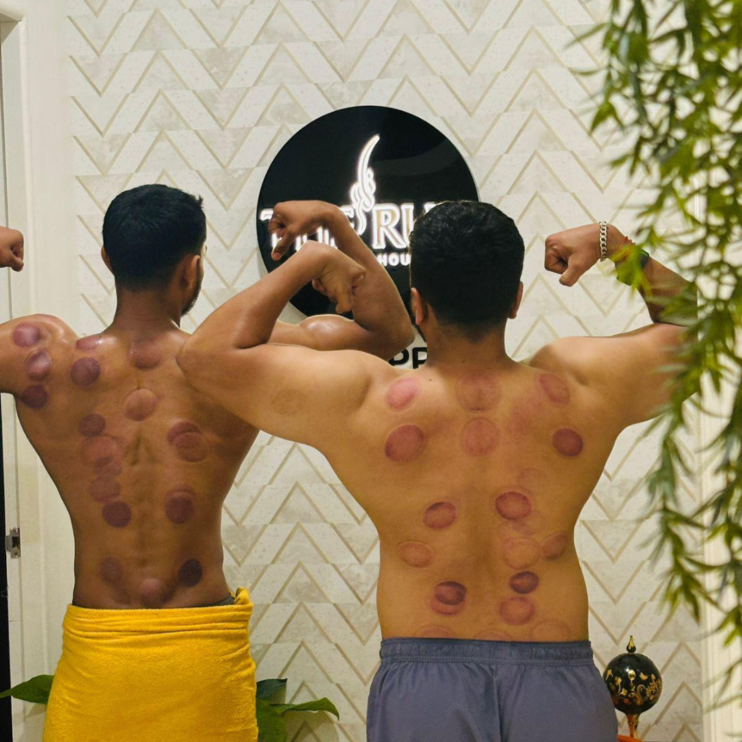 Hijama and Cupping Customers