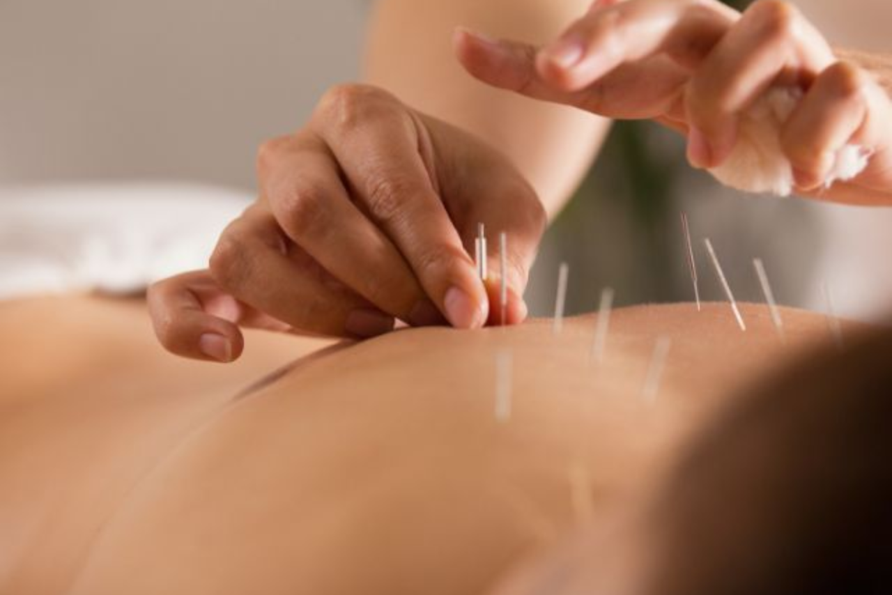 Acupuncture at Ruh Holistic care